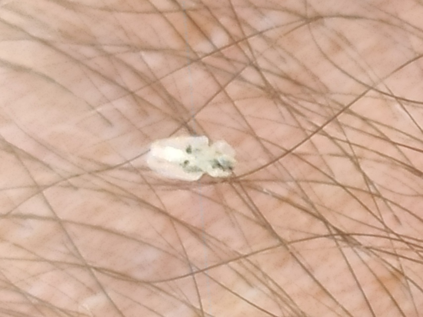 Corythucha ciliata - platán-csipkéspoloska